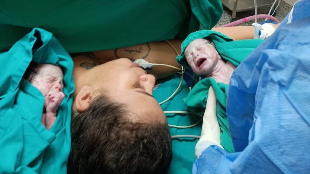 Jovem dá à luz trigêmeas após gravidez rara em RO: 'Tudo deu certo'