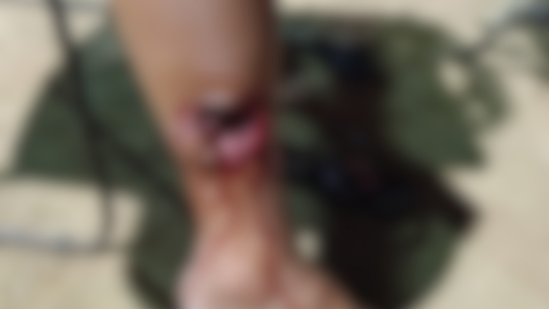 Cães soltos causam ataques e deixam moradores em alerta próximo à residência do DER