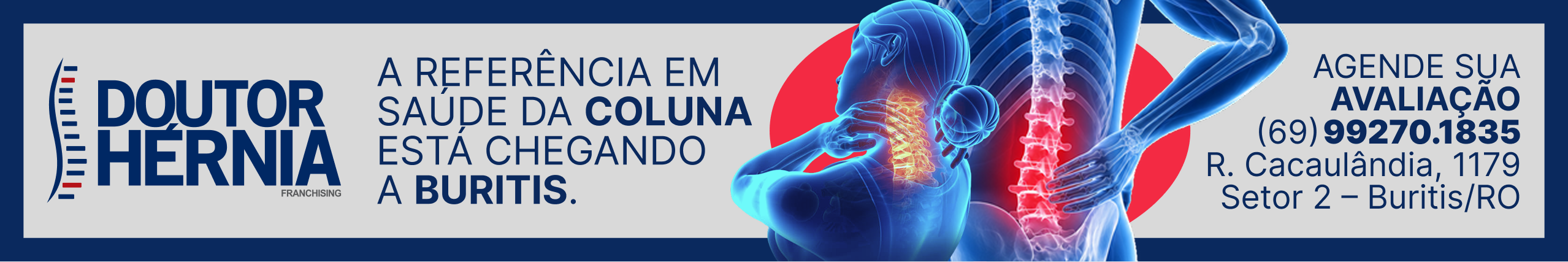DOUTOR HERNIA  - 27