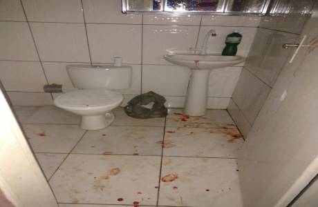 Homem é baleado na cabeça por grupo que invadiu casa no Garimpo Bom Futuro, RO