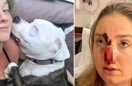 Mulher é atacada por cão após ele se irritar com luz de placa dental